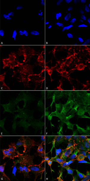 Immunocytochemistry/Immunofluorescence analysis using Mouse Anti-Acrolein Monoclonal Antibody, Clone 2H2 (STMA00177). Tissue: Embryonic kidney epithelial cell line (HEK293). Species: Human. Fixation: 5% Formaldehyde for 5 min. Primary Antibody: Mouse Anti-Acrolein Monoclonal Antibody (STMA00177) at 1:50 for 30-60 min at RT. Secondary Antibody: Goat Anti-Mouse Alexa Fluor 488 at 1:1500 for 30-60 min at RT.