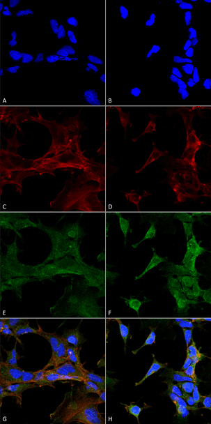 Immunocytochemistry/Immunofluorescence analysis using Mouse Anti-4-Hydroxy-2-hexenal Monoclonal Antibody, Clone 6F10 (STMA00181). Tissue: Embryonic kidney epithelial cell line (HEK293). Species: Human. Fixation: 5% Formaldehyde for 5 min. Primary Antibody: Mouse Anti-4-Hydroxy-2-hexenal Monoclonal Antibody (STMA00181) at 1:400 for 30-60 min at RT. Secondary Antibody: Goat Anti-Mouse Alexa Fluor 488 at 1:1500 for 30-60 min at RT.
