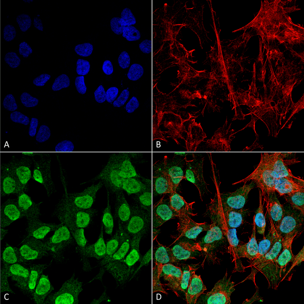 Immunocytochemistry/Immunofluorescence analysis using Mouse Anti-Alpha Synuclein Monoclonal Antibody, Clone 3F8 (STMA00193). Tissue: Neuroblastoma cell line (SK-N-BE). Species: Human. Fixation: 4% Formaldehyde for 15 min at RT. Primary Antibody: Mouse Anti-Alpha Synuclein Monoclonal Antibody (STMA00193) at 1:100 for 60 min at RT. Secondary Antibody: Goat Anti-Mouse ATTO 488 at 1:200 for 60 min at RT.