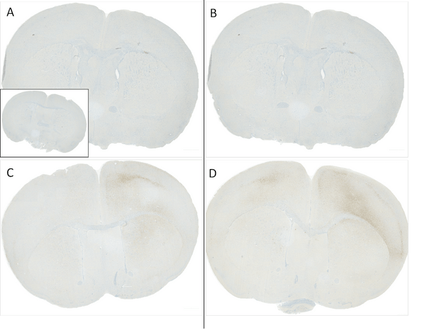 Immunohistochemistry analysis using Rabbit Anti-Alpha Synuclein pSer129 Monoclonal Antibody, Clone J18 (STMA00206). Tissue: Brain. Species: Mouse. Primary Antibody: Rabbit Anti-Alpha Synuclein pSer129 Monoclonal Antibody (STMA00206) at 1:10000. Secondary Antibody: anti-rabbit HRP. C57/BL6 mice were injected with 5 ug sonicated mouse recombinant alpha synuclein PFFs at 8 weeks of age.