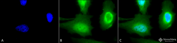 Immunocytochemistry/Immunofluorescence analysis using Rabbit Anti-Calreticulin Polyclonal Antibody (STPA00017). Tissue: Heat Shocked Cervical cancer cell line (HeLa). Species: Human. Fixation: 2% Formaldehyde for 20 min at RT. Primary Antibody: Rabbit Anti-Calreticulin Polyclonal Antibody (STPA00017) at 1:100 for 12 hours at 4°C. Secondary Antibody: FITC Goat Anti-Rabbit (green) at 1:200 for 2 hours at RT.