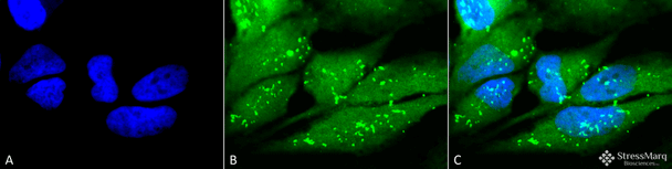 Immunocytochemistry/Immunofluorescence analysis using Rabbit Anti-p38 Polyclonal Antibody (STPA00027). Tissue: Cervical cancer cell line (HeLa). Species: Human. Fixation: 2% Formaldehyde for 20 min at RT. Primary Antibody: Rabbit Anti-p38 Polyclonal Antibody (STPA00027) at 1:100 for 12 hours at 4°C. Secondary Antibody: FITC Goat Anti-Rabbit (green) at 1:200 for 2 hours at RT. Counterstain: DAPI (blue) nuclear stain at 1:40000 for 2 hours at RT.