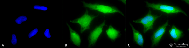 Immunocytochemistry/Immunofluorescence analysis using Rabbit Anti-Rab5 Polyclonal Antibody (STPA00025). Tissue: Cervical cancer cell line (HeLa). Species: Human. Fixation: 2% Formaldehyde for 20 min at RT. Primary Antibody: Rabbit Anti-Rab5 Polyclonal Antibody (STPA00025) at 1:80 for 12 hours at 4°C. Secondary Antibody: R-PE Goat Anti-Rabbit (yellow) at 1:200 for 2 hours at RT.