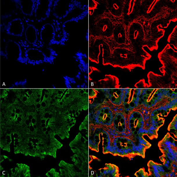 Immunohistochemistry analysis using Rabbit Anti-NHE3 Polyclonal Antibody (STPA00044). Tissue: Colon. Species: Rat. Fixation: Formalin Fixed Paraffin-Embedded. Primary Antibody: Rabbit Anti-NHE3 Polyclonal Antibody (STPA00044) at 1:25 for 1 hour at RT. Secondary Antibody: Goat Anti-Rabbit IgG:Alexa Fluor 488. Counterstain: Actin-binding Phalloidin-Alexa Fluor 633; DAPI (blue) nuclear stain. Magnification: 63X. (A) DAPI (blue) nuclear stain.