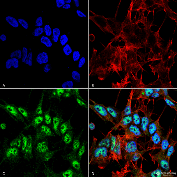 Immunocytochemistry/Immunofluorescence analysis using Rabbit Anti-Beclin 1 Polyclonal Antibody (STPA00057). Tissue: Neuroblastoma cell line (SK-N-BE). Species: Human. Fixation: 4% Formaldehyde for 15 min at RT. Primary Antibody: Rabbit Anti-Beclin 1 Polyclonal Antibody (STPA00057) at 1:100 for 60 min at RT. Secondary Antibody: Goat Anti-Rabbit ATTO 488 at 1:100 for 60 min at RT.