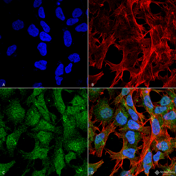 Immunocytochemistry/Immunofluorescence analysis using Rabbit Anti-UVRAG Polyclonal Antibody (STPA00059). Tissue: Neuroblastoma cell line (SK-N-BE). Species: Human. Fixation: 4% Formaldehyde for 15 min at RT. Primary Antibody: Rabbit Anti-UVRAG Polyclonal Antibody (STPA00059) at 1:100 for 60 min at RT. Secondary Antibody: Goat Anti-Rabbit ATTO 488 at 1:100 for 60 min at RT.