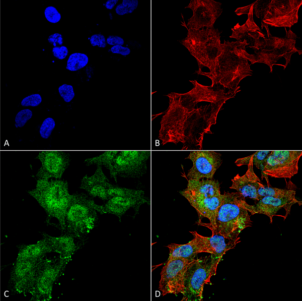 Immunocytochemistry/Immunofluorescence analysis using Rabbit Anti-Calcium Sensing Receptor Polyclonal Antibody (STPA00075). Tissue: Neuroblastoma cell line (SK-N-BE). Species: Human. Fixation: 4% Formaldehyde for 15 min at RT. Primary Antibody: Rabbit Anti-Calcium Sensing Receptor Polyclonal Antibody (STPA00075) at 1:100 for 60 min at RT. Secondary Antibody: Goat Anti-Rabbit ATTO 488 at 1:200 for 60 min at RT.