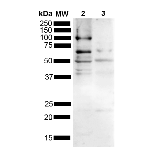 Western blot analysis of Mouse, Rat Brain showing detection of Multiple bands due to different isoforms/aggregation states Tau protein using Rabbit Anti-Tau Polyclonal Antibody (STPA00089). Lane 1: MW Ladder. Lane 2: Mouse brain (15 ug). Lane 2: Rat brain (15 ug). Load: 15 ug. Block: 5% Skim Milk powder in TBST. Primary Antibody: Rabbit Anti-Tau Polyclonal Antibody (STPA00089) at 1:1000 for 2 hours at RT with shaking.