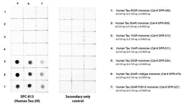 Dot blot analysis comparing detection of Tau isoforms. Of note is that STPA00091 does not bind to 0N or 1N isoforms. Block: 5% skim milk. Primary Antibody: Anti-human Tau 2N3R/4R polyclonal antibody (STPA00091) incubated for 1/2 hour at RT. Secondary Antibody: Goat anti-rabbit IgG:HRP at 1:4000 for 1/2 hour at RT. Color Development: Chemiluminescent for HRP (Moss) for 1 min in RT. Exposed 1 second.