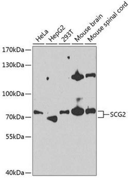 Anti-SCG2 Antibody (CAB13563)