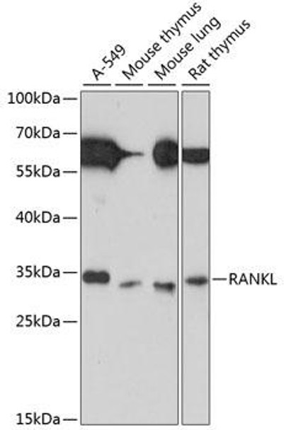 Anti-RANKL Antibody (CAB13567)