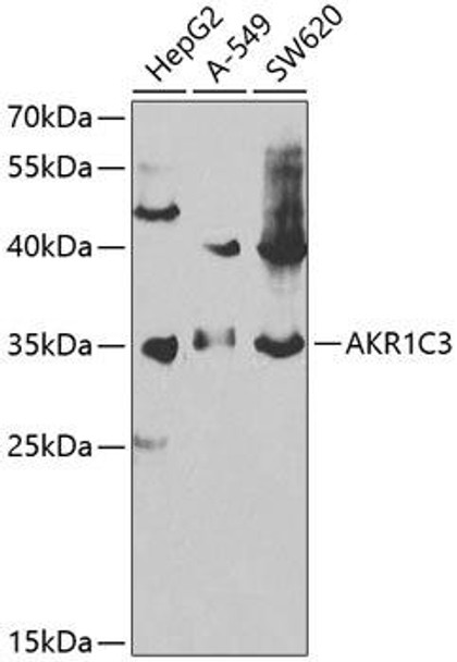 Anti-AKR1C3 Antibody (CAB13568)