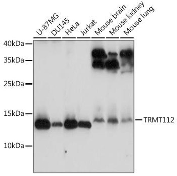 Anti-TRMT112 Antibody (CAB14310)