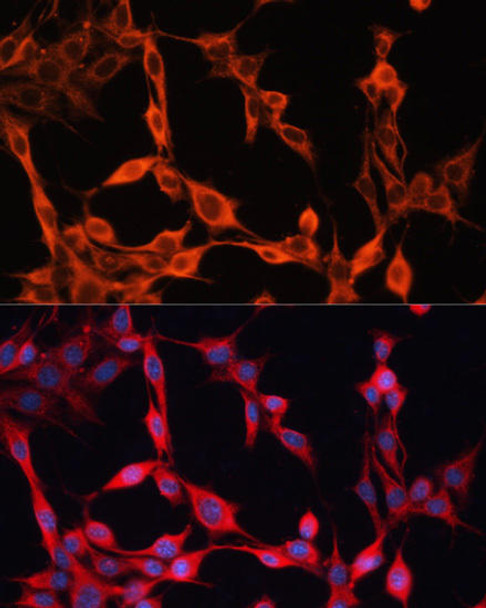 Anti-SLC25A23 Antibody (CAB14352)