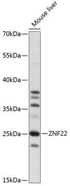 Anti-ZNF22 Antibody (CAB14798)