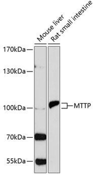 Anti-MTTP Antibody (CAB1746)
