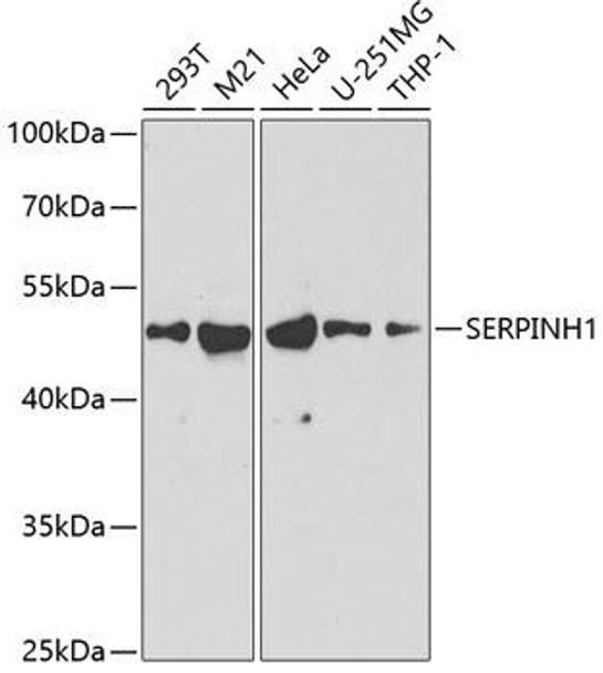 Anti-SERPINH1 Antibody (CAB2517)