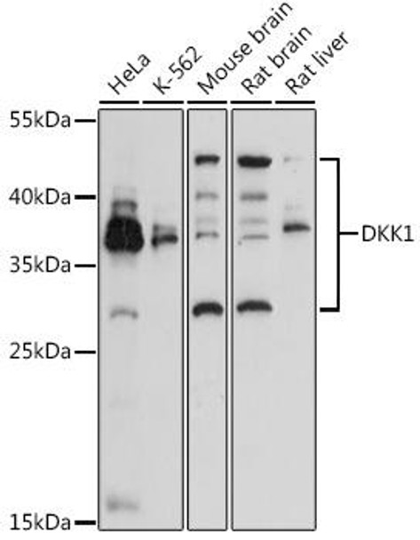 Anti-DKK1 Antibody (CAB2562)