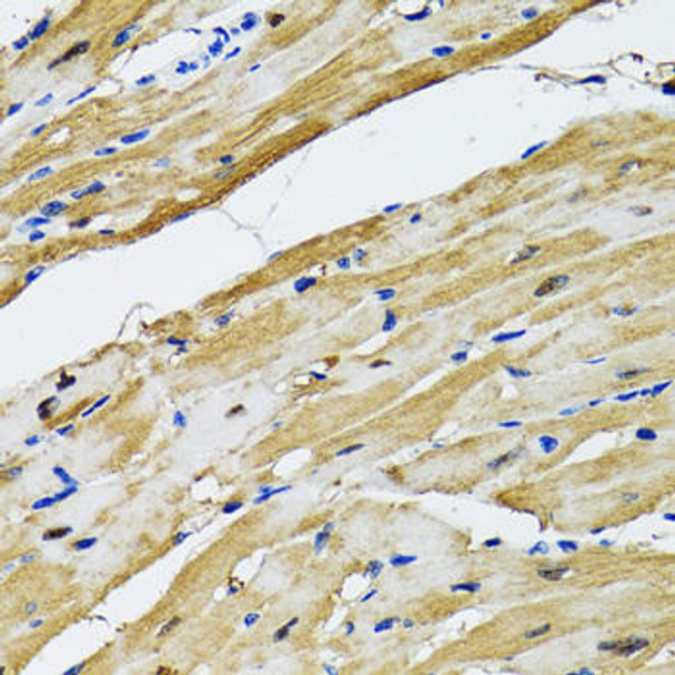 Anti-GOT1 Antibody (CAB5822)