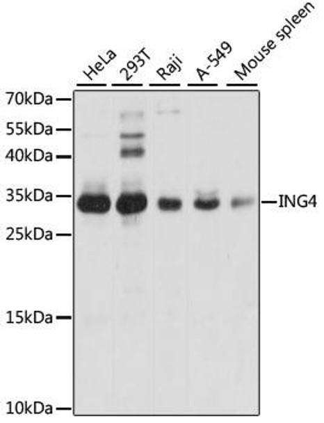 Anti-ING4 Antibody (CAB5833)