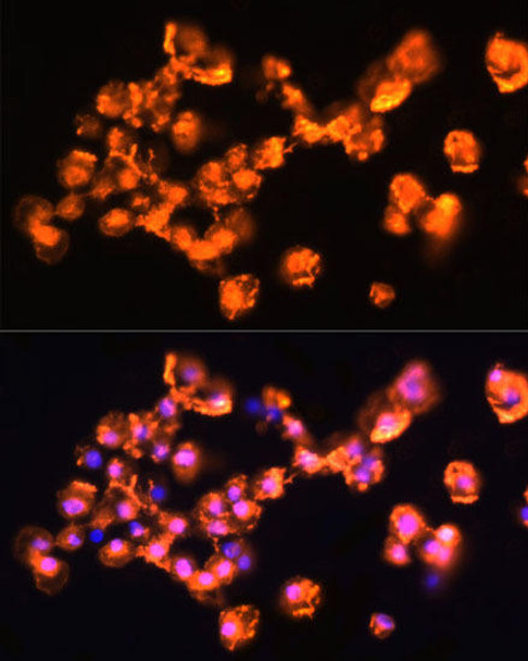 Anti-PRKCB Antibody (CAB5845)