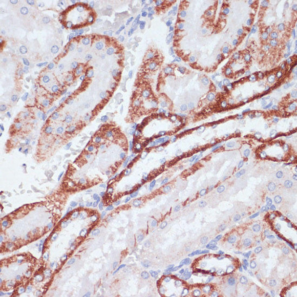 Anti-TFRC Antibody (CAB5865)