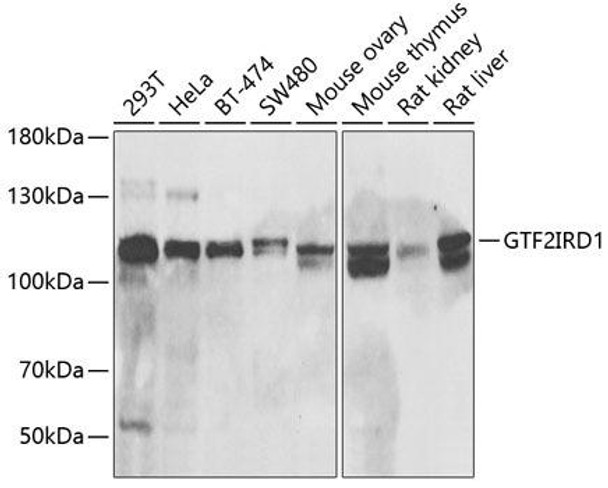 Anti-GTF2IRD1 Antibody (CAB6613)