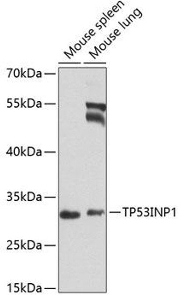 Anti-TP53INP1 Antibody (CAB8274)