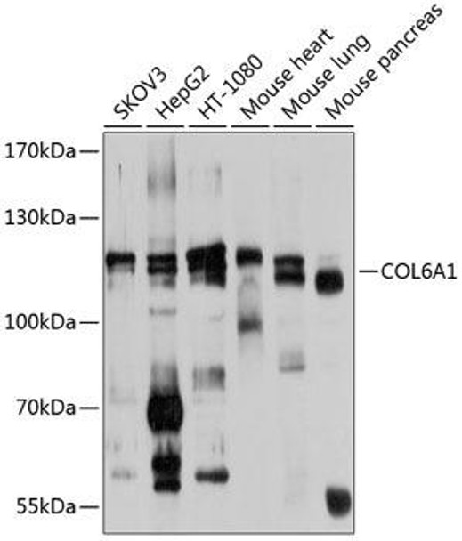 Anti-COL6A1 Antibody (CAB9236)