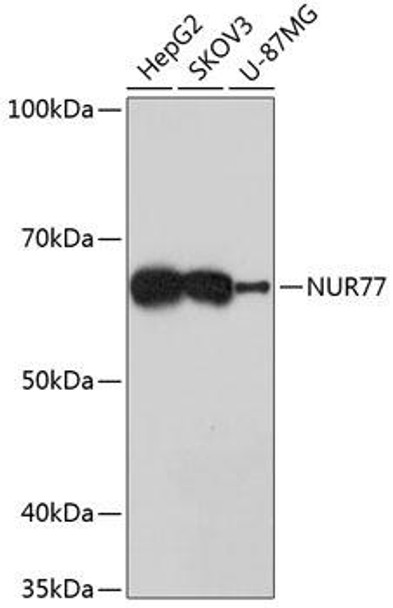 Anti-NUR77 Antibody (CAB11703)