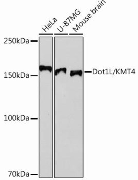 Anti-Dot1L/KMT4 Antibody (CAB12329)