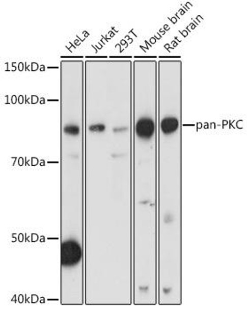 Anti-pan-PKC Antibody (CAB17922)