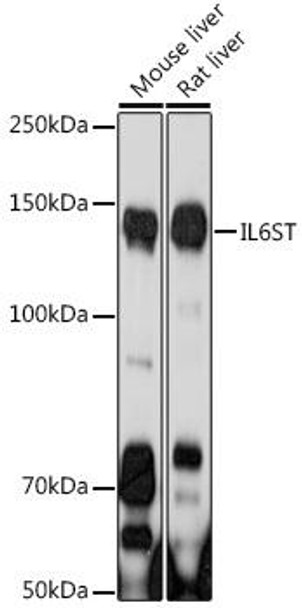 Anti-IL-6ST Antibody (CAB18036)[KO Validated]