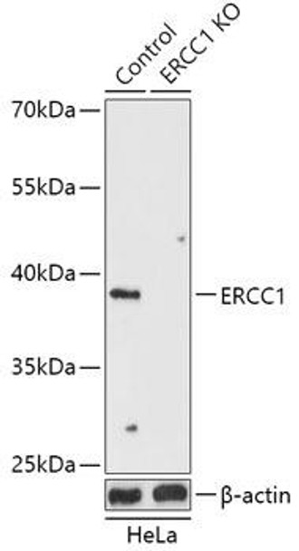 Anti-ERCC1 Antibody (CAB18066)[KO Validated]