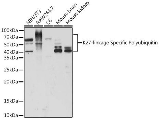 Anti-K27-linkage Specific Polyubiquitin Antibody (CAB18202)