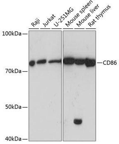 Anti-CD86 Antibody (CAB19026)