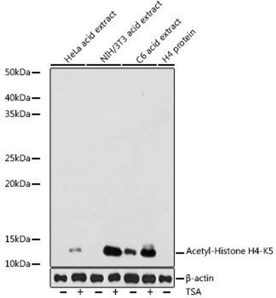 Anti-Acetyl-Histone H4-K5 Antibody (CAB19525)