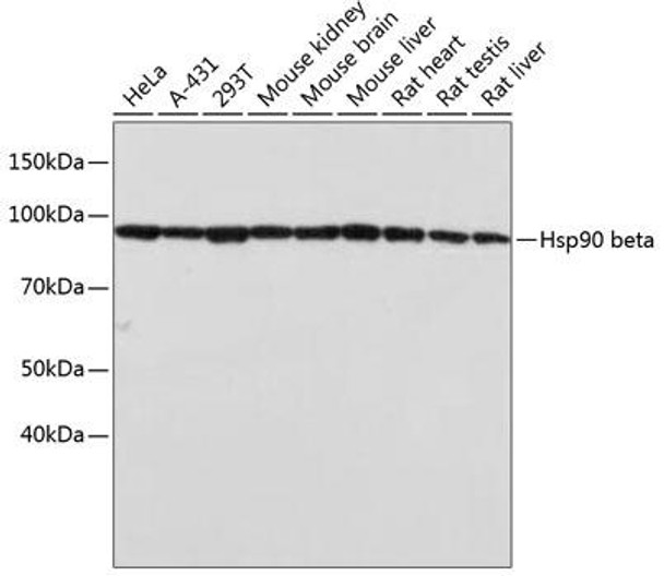 Anti-Hsp90 beta Antibody (CAB19574)