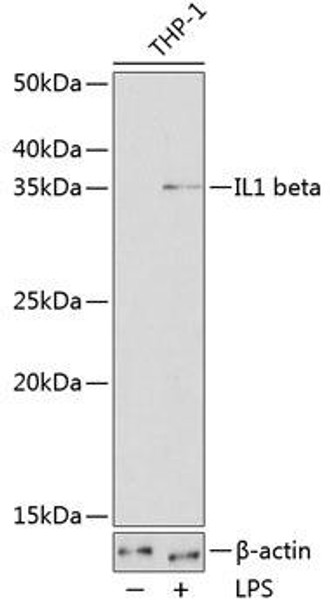 Anti-IL-1 beta Antibody (CAB19635)