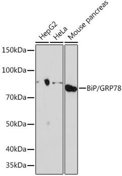 Anti-BiP/GRP78 Antibody (CAB4908)