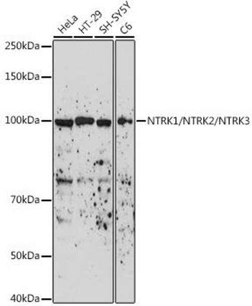 Anti-NTRK1/NTRK2/NTRK3 Antibody (CAB18809)