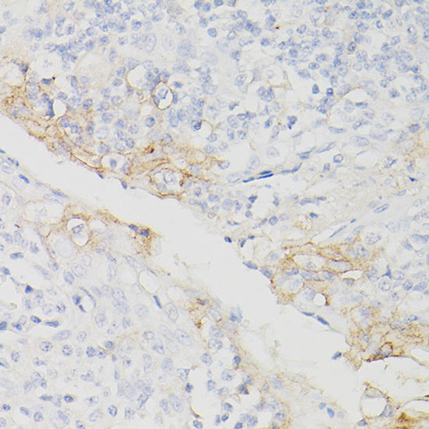 Anti-PD-L1/CD274 Antibody (CAB20344)