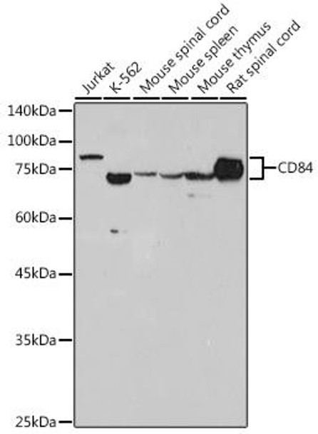 Anti-CD84 Antibody (CAB2299)