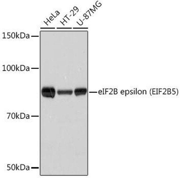 Anti-eIF2B epsilon (EIF2B5) Antibody (CAB8670)