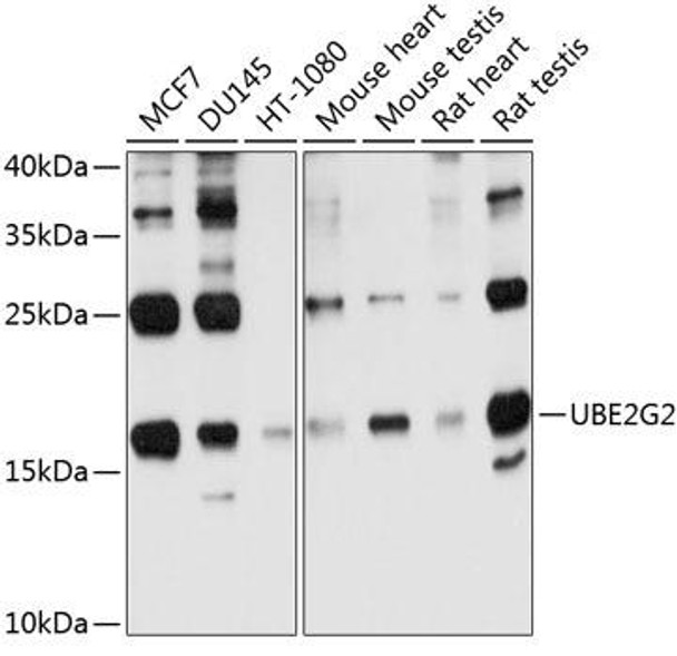 Anti-UBE2G2 Antibody (CAB10408)