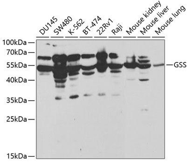 Anti-GSS Antibody (CAB1069)