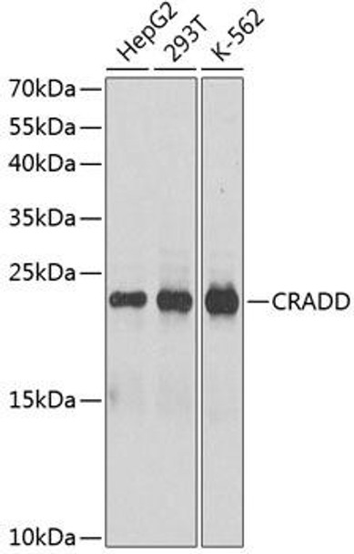 Anti-CRADD Antibody (CAB1124)
