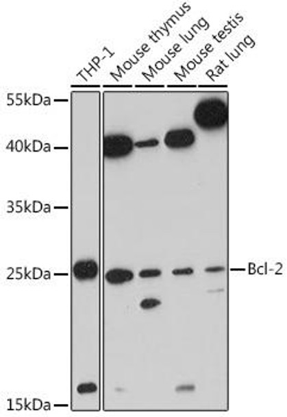 Anti-Bcl-2 Antibody (CAB11313)