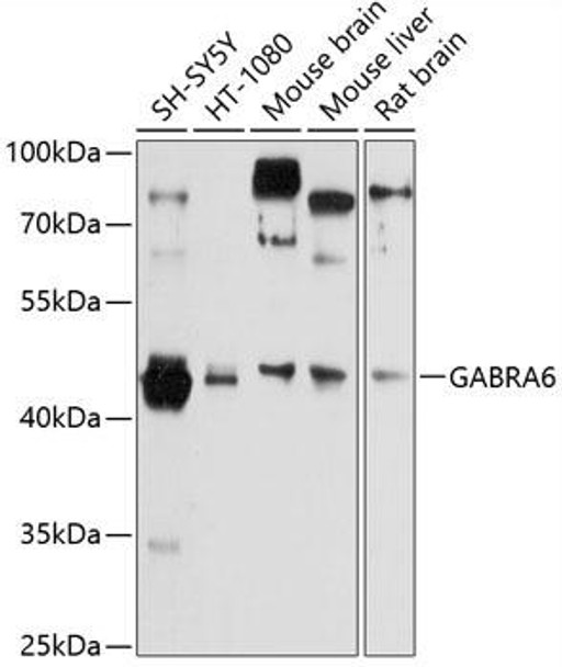 Anti-GABRA6 Antibody (CAB12750)