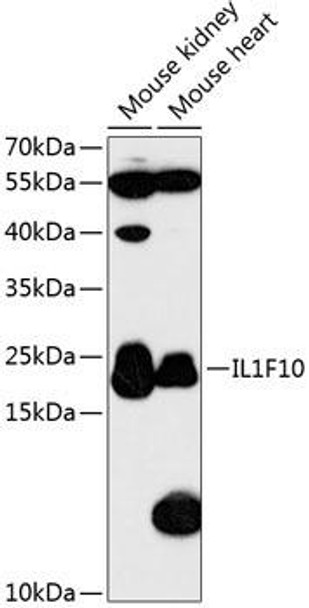 Anti-IL-1F10 Antibody (CAB13133)